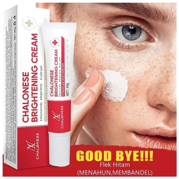 BUY 1 GET 1 FREE CHALONESE CREAM 20g