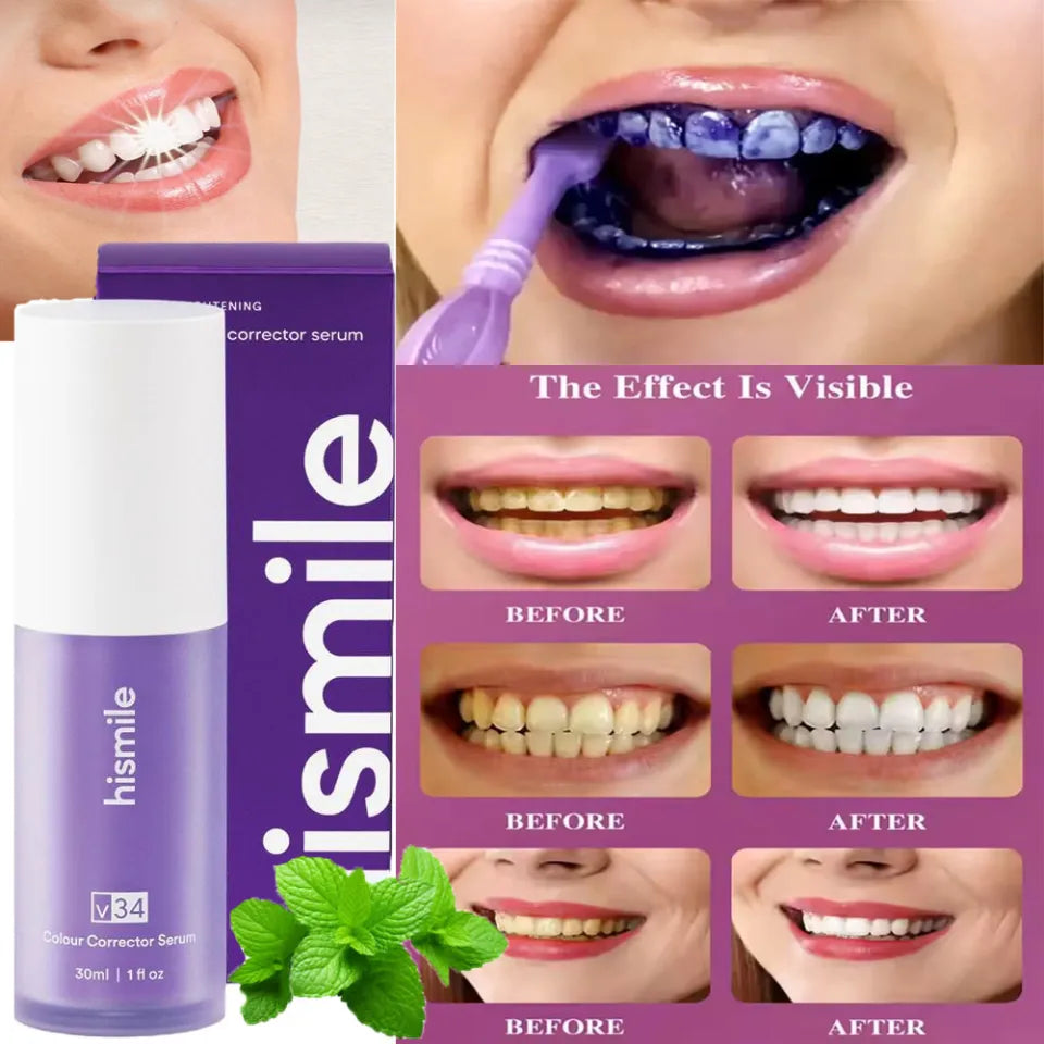 Hismile v34 Colour Corrector Serum Purple Teeth Whitening & Stain Removal