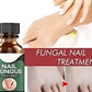 Nail Fungus Treatment Serum 10ml