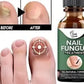 Nail Fungus Treatment Serum 10ml