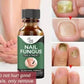 Nail Fungus Treatment Serum 10ml