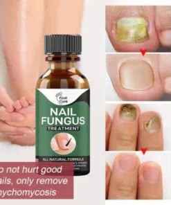 Nail Fungus Treatment Serum 10ml